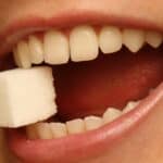 Sugar cause yellow teeth - Cedar Rapids, IA - Dental Touch Associates