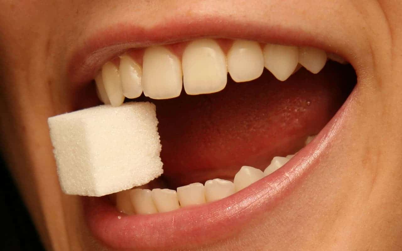 Sugar cause yellow teeth - Cedar Rapids, IA - Dental Touch Associates